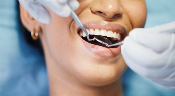 Best Emergency Wisdom Teeth Removal in Hurstbourne Acres, KY