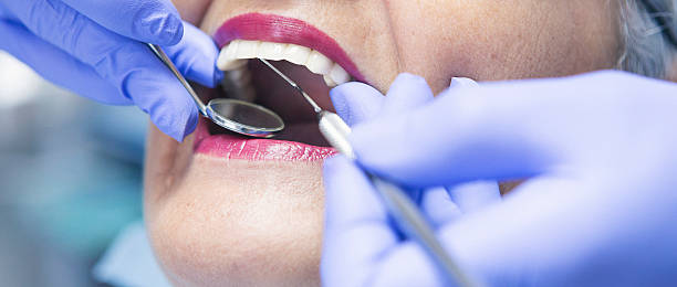 Best Emergency Dental Care for Broken or Chipped Teeth in Hurstbourne Acres, KY